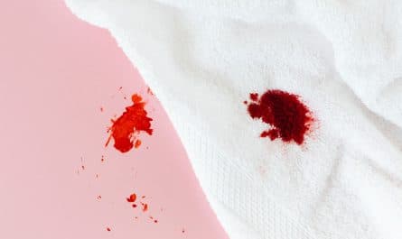 Comment enlever une tache de sang sur un matelas en 5 minutes chrono !